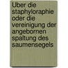 Über Die Staphyloraphie Oder Die Vereinigung Der Angebornen Spaltung Des Saumensegels by Phil. Jos. Roux