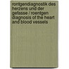 Rontgendiagnostik Des Herzens Und Der Gefasse / Roentgen Diagnosis of the Heart and Blood Vessels door H.H. Lohr