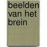 Beelden van het brein door Ira van Keulen