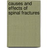 Causes and effects of spinal fractures door Rene Aquarius