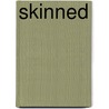 Skinned by Antjie Krog