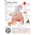 Copd And Asthma
