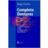 Complete Dentures