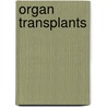 Organ Transplants by Diane Andrews Henningfeld