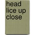 Head Lice Up Close