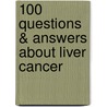 100 Questions & Answers About Liver Cancer door Ronald Dematteo