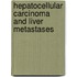Hepatocellular Carcinoma and Liver Metastases