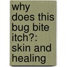 Why Does This Bug Bite Itch?: Skin And Healing door Steven Parker