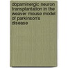 Dopaminergic Neuron Transplantation in the Weaver Mouse Model of Parkinson's Disease door Lazaros C. Triarhou
