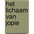 Het lichaam van Jopie