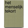 Het menselijk tekort door André Malraux