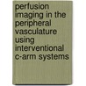 Perfusion imaging in the peripheral vasculature using interventional C-arm systems by M. Giordano