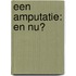 Een amputatie: en nu?