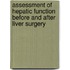 Assessment of hepatic function before and after liver surgery