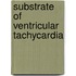 Substrate of ventricular tachycardia
