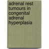 Adrenal rest tumours in congenital adrenal hyperplasia by H.L. Claahsen van der Grinten