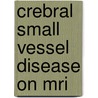 Crebral Small Vessel Disease On Mri door A.A. Gouw