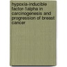 Hypoxia-Inducible Factor-1alpha in carcinogenesis and progression of breast cancer door Ruben Bos