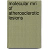 Molecular Mri Of Atherosclerotic Lesions door Brigit den Adel