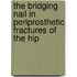 The Bridging nail in periprosthetic fractures of the hip