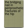 The Bridging nail in periprosthetic fractures of the hip door R.G. Zuurmond