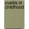 Uveitis in Childhood door K.M. Sijssens