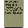 Stereoactic large-core needle biopsy for nonpalpable breast disease door H.M. Verkooijen