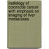Radiology of colorectal cancer with emphasis on imaging of liver metastases