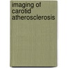 Imaging of carotid atherosclerosis door R.M. Kwee