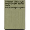 Detection and analysis of epileptiform activity in the electroencephalogram door P. Hese
