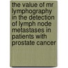 The Value Of Mr Lymphography In The Detection Of Lymph Node Metastases In Patients With Prostate Cancer by A.M. Hvels