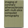 Imaging of Coronary Atherosclerosis With Multi-Slice Computed Tomography by G. Pundziute