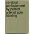 Cerebral Perfusion Mri By Pulsed Arterial Spin Labeling
