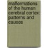 Malformations of the Human Cerebral Cortex: Patterns and causes