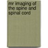 Mr Imaging of the Spine and Spinal Cord