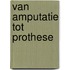 Van amputatie tot prothese