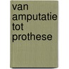Van amputatie tot prothese by M. Feenstra