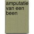 Amputatie van een been