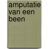 Amputatie van een been door K. Rosenbrandt