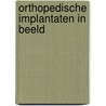 Orthopedische implantaten in beeld by Liza van Steenbergen