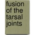 Fusion of the Tarsal Joints