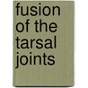 Fusion of the Tarsal Joints by Mark Stegeman