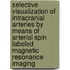 Selective visualization of intracranial arteries by means of arterial spin labeled magnetic resonance imaging