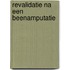 Revalidatie na een beenamputatie