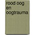 Rood oog en oogtrauma