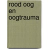 Rood oog en oogtrauma door Riny Luiten