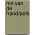 MRI van de hand/pols