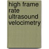 High Frame Rate Ultrasound Velocimetry door Jason Voorneveld