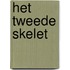 Het tweede skelet