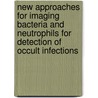 New approaches for imaging bacteria and neutrophils for detection of occult infections door Sveva Auletta